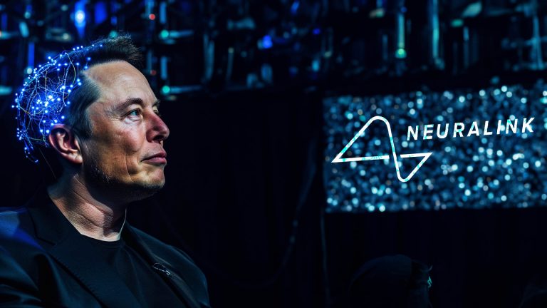 Elon Musk Franchit Une Nouvelle Tape Premier Implant C R Bral De